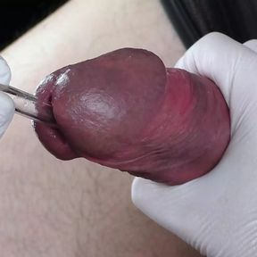 Perfect extraction of sperm directly from the urethra. Close-up of the glass straw sounding.