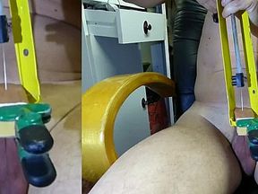 auto needle in prepuc foreskin with modified cartridge glue diffuser