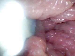 Endoscope camera shows the almost all sensitive parts of the dong Educational episode