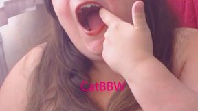 ANOTHER Tooth Extracted! An Update - Dental Fetish & Kink
