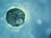 Internal views - Endoscope inside ass , cock , mouth - endoscope anal insertion, urethral insertion