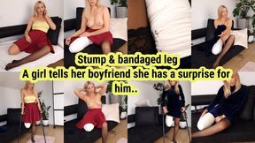 A girl tells her boyfriend she has a surprise for him.. stump and bandaged leg