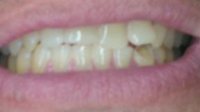 I collect spit in my mouth and show you my tongue and uvula in Close-Up