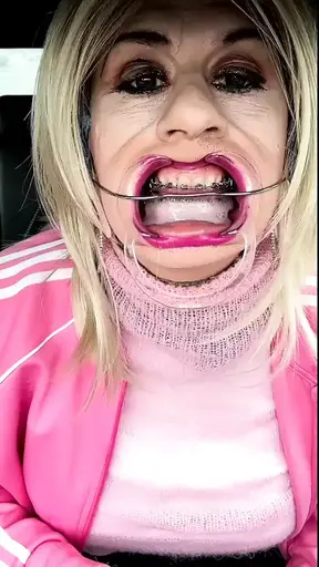 There&#039;s cum on my braces headgear...