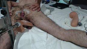 13+ Creamy Anal Orgasms+ Big Shooting Load with Fuck Machine