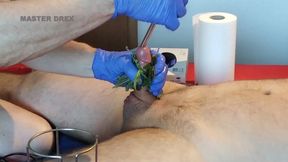 CBT and nettles