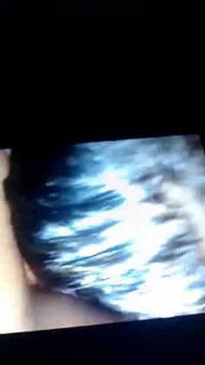 Aninha morena caiu na net