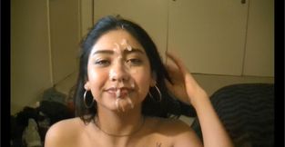 18 Year Old Gets A Huge Facial