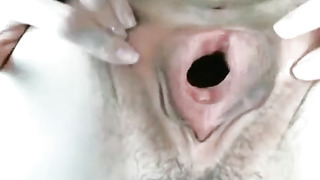 Webcam Gaping