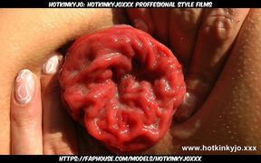 When the Dreams Come True Anal Fisting &amp; Prolapse by Hotkinkyjo
