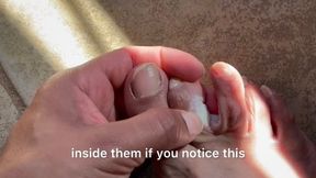 Cutting my toenails with a fungal infection