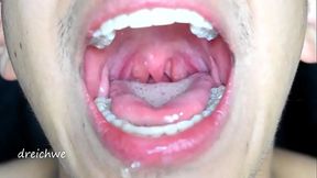 Large uvula and hot