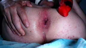 Stretching twink hole and moaning