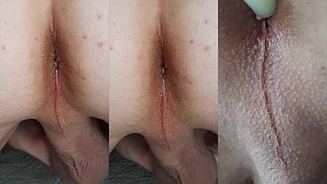 My Ass Up Orgasm Contractions of Glistening Anus 1:20 with Self Insemination 2:06