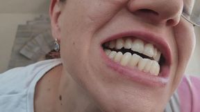 CLOSE-UP CIGARETTE SMOKING – SHOWING MY TEETH & MOUTH AFTER TWO WEEKS UNBRUSHED