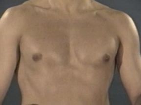 Forever More Foreskin