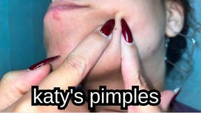 Pimple Popping and Blackhead Squeezing Up Close