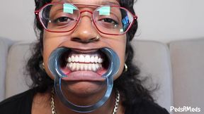 Youronlyphoenix Dental Retractor Mouth Tour
