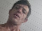 Prolapso