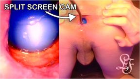 Split Screen Look inside Lina's Gaping Ass with Eggs