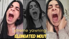 Extreme yawning + elongated mouth