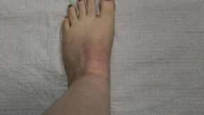 Fruit and toes