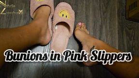 Bunions in Pink Fuzzy Slippers