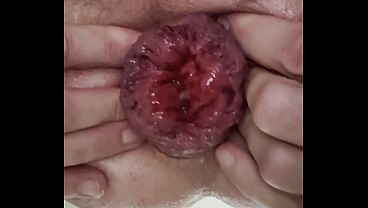 Anal whore practices rosebud and prolapse and fisting