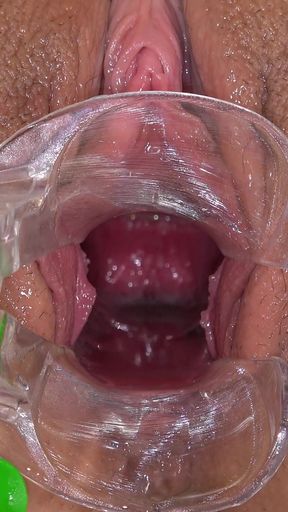 Pussy Exam of Hot College Student Juliia