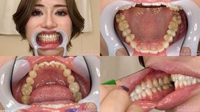 ERINA - Watching Inside mouth of Japanese cute girl bite-255-1 - MOV