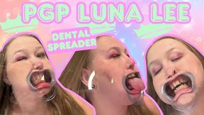Plexiglass Princess Luna Lee Dental Apparatus