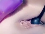 Inflation catheter inside my pee hole and pull it out