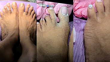 Dry Pedicure After 3 Months of Growth!!!