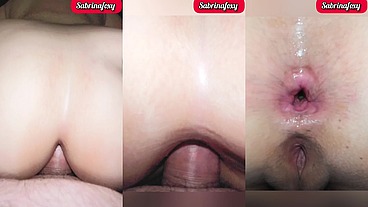 COLOMBIANA SABRINAFOXY. Fui al médico por culpa de mi ANSIEDAD ANAL, y me aplico un tratamiento fuerte para curarme. Me rompe el CULO y deja su leche adentro