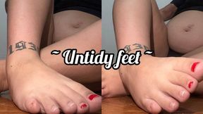Dry feet and chipped toenails