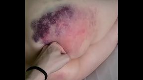 Having fun with slow-mo on my beautifully bruised butt!