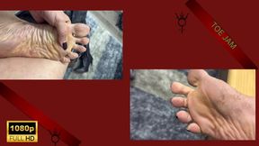 Foot Gunk of EmpressBellaSadic DIRTY FEET TOE JAM WRINKLED SOLES FEMALE SWEATY FEET