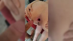 A wid anal sex is the best therapy for a horny couple of lovers