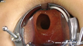 Incredible deep anal view with XO speculum and light in Hotkinkyjo ass