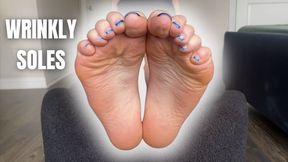 Wrinkly Soles