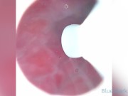 CAMERA INSIDE VAGINA AFTER INTERNAL CREAMPIE - ส่องกล้องดูอสุจิในช่องคลอด