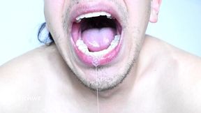uvula con saliva
