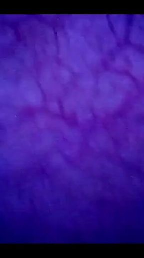 Beautiful Inside POV of My Full Bladder with the Endoscope!