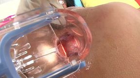 Hot girls show inside their anus with a vaginal speculum