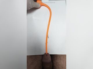 yellow in the urethra