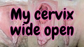 My cervix inside