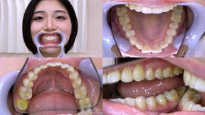 Inori Mano - Watching Inside mouth of Japanese cute girl