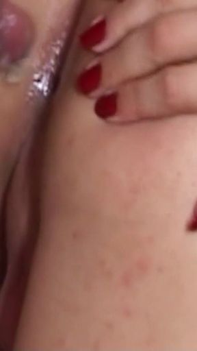 Skinny Blonde Tranny Nurse Fucked Anally by Patients