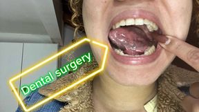 Oral surgery