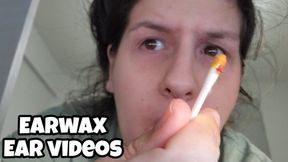 Earwax Removal & Ear Touching Compilation 1 month Chubby Girl Cleans Ears